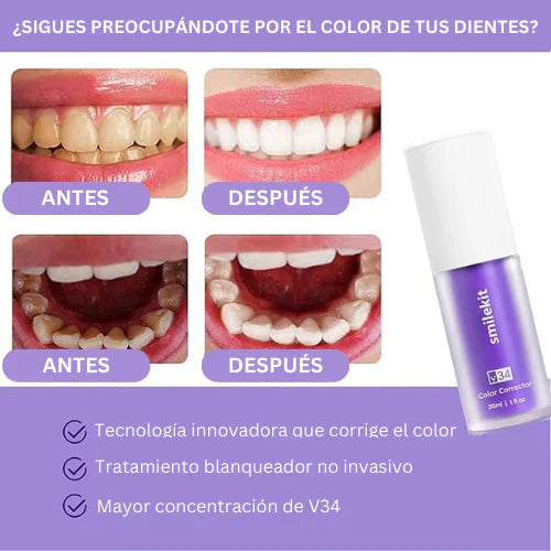 Blanqueador Dental V34™ - TRENDFINDER® (2024) ✅